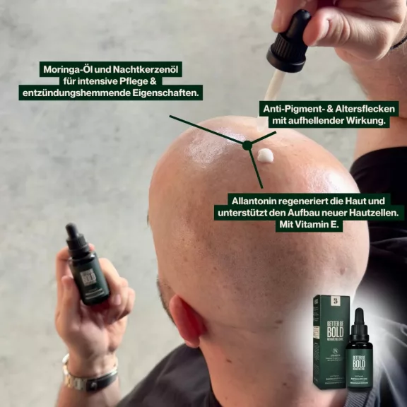Better Be Bold Anti-Pigment kopaszfej szérum 50 ml Better Be Bold Anti-Pigment kopaszfej szérum 50 ml